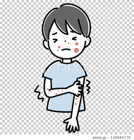 発疹で辛い子供のイラスト 発疹で辛い子供のイラスト 128044176