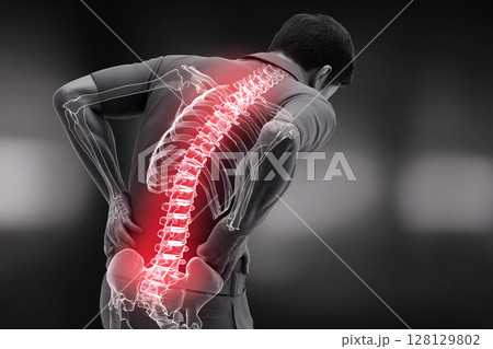 Back Pain X-ray Illustration 128129802