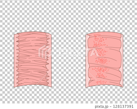 消化器の解剖生理　空腸と回腸の輪状ひだ　文字なし 128137391