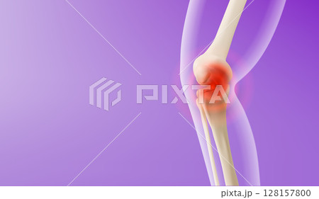3d knee pain visualization 3d knee pain visualization 128157800