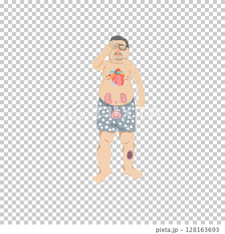 A middle-aged man with physical findings of diabetic complications (illustration material) 128163693