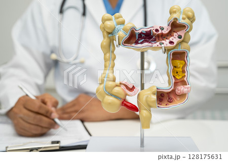 Intestine, appendix and digestive system, doctor holding anatomy model for study diagnosis and treatment in hospital. 128175631