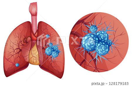Detailed Vector Illustration of Lung Anatomy and Cells 128179183