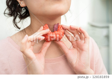 Hyperthyroidism, Overactive Thyroid, Thyroid Lymphoma, Asian woman with thyroid gland human anatomy model. Hyperthyroidism, Overactive Thyroid, Thyroid Lymphoma, Asian woman with thyroid gland human anatomy model. 128181859