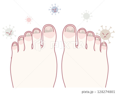 Maintaining Healthy Feet Effective Ways to Guard Against Various Viruses and Infections 128274801