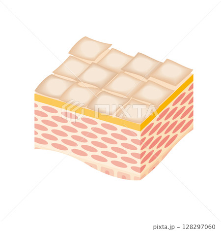 乾燥した肌断面図　イラスト 128297060