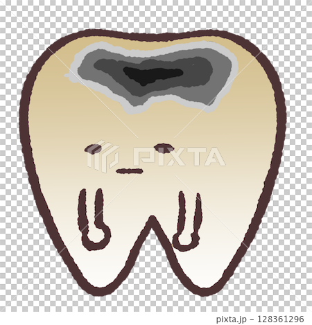 色素蛀牙的插圖 128361296