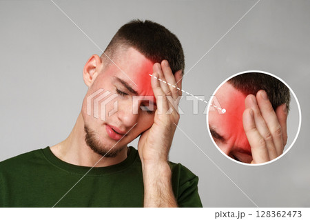 Man experiencing headache with visible discomfort in an indoor setting during daylight hours 128362473