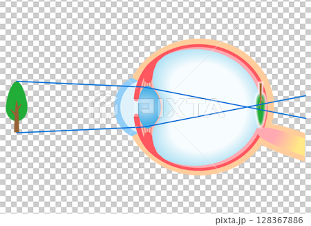 目の構造　軸性近視　視力 128367886