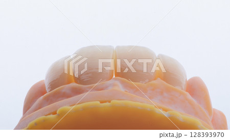 High-quality four dental crowns made of zirconium for fixation to the frontal teeth of upper jaw. 128393970