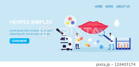 Herpes simplex virus on human lips. Dermatological disease with watery blisters in the skin. STD infection. Doctors diagnosis HSV virus. Clinical exam, visual inspection, laboratory tests 128403174
