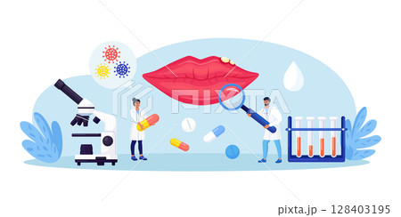 Herpes simplex virus on human lips. Dermatological disease with watery blisters in the skin. STD infection. Doctors diagnosis HSV virus. Clinical exam, visual inspection, laboratory tests 128403195