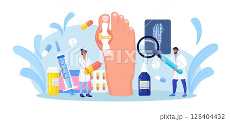 Gout treatment. Arthritis joint in the ankle. Doctor diagnoses swollen and inflamed foot joint. Physician looking at x-ray scan. Human feet bone with uric acid crystals. Medical appointment and exam Gout treatment. Arthritis joint in the ankle. Doctor diagnoses swollen and inflamed foot joint. Physician looking at x-ray scan. Human feet bone with uric acid crystals. Medical appointment and exam 128404432