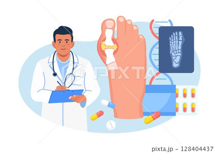 Gout treatment. Arthritis joint in the ankle. Doctor diagnoses swollen and inflamed foot joint. Physician looking at x-ray scan. Human feet bone with uric acid crystals. Medical appointment and exam 128404437