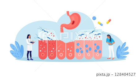 Helicobacter pylori infection. Bacterium with flagella damage stomach tissue. Digestive tract diseases, gastritis. Doctor inspecting stomach, intestine microflora, gut microorganisms. Gastroenterology 128404527