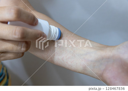 汗疹にかゆみ止めを塗っている 汗疹にかゆみ止めを塗っている 128467836