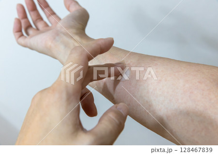 汗疹に塗り薬を塗っている 汗疹に塗り薬を塗っている 128467839