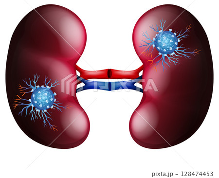 Detailed Vector Illustration of Human Kidneys Detailed Vector Illustration of Human Kidneys 128474453