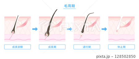 毛周期・ヘアサイクルのイラスト図解(成長期・退行期・休止期) 毛周期・ヘアサイクルのイラスト図解(成長期・退行期・休止期) 128502850