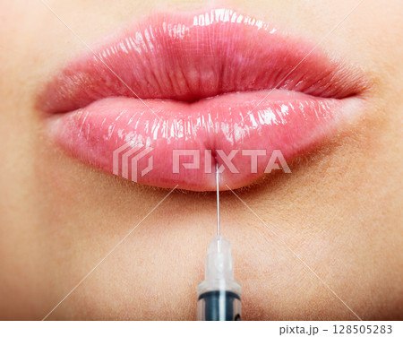 Closeup shot of beautiful female lips and syringe with filler Closeup shot of beautiful female lips and syringe with filler 128505283