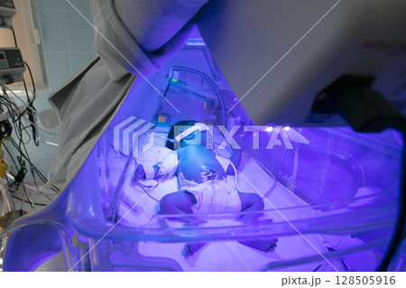 Newborn child baby having a treatment for jaundice under ultraviolet light in incubator. A neonatal intensive care unit NICU , intensive care nursery ICN for premature newborn infants Newborn child baby having a treatment for jaundice under ultraviolet light in incubator. A neonatal intensive care unit NICU , intensive care nursery ICN for premature newborn infants 128505916