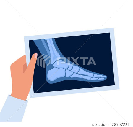 X ray human foot. X-ray picture or radiographic monitor image of metatarsus bones and toes. Medical radiology. Roentgen shot in doctors hand. Vector illustration. 128507221