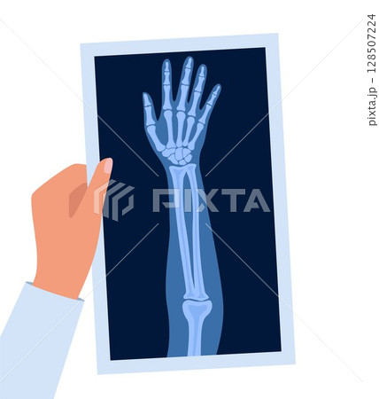 X ray human hand. Body bone roentgen front view. Medical anatomy. Arm checking healthcare joint palm finger exam. Roentgen shot in doctors hand. Vector illustration. 128507224