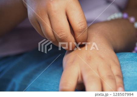 Child scratching arm in a relaxed setting during daytime Child scratching arm in a relaxed setting during daytime 128507994