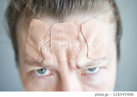 Close-up of caucasian female adult with wrinkled forehead and patches for skin Close-up of caucasian female adult with wrinkled forehead and patches for skin 128545406