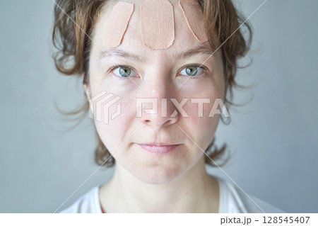 Caucasian young adult female with bandages on forehead looking forward, soft Caucasian young adult female with bandages on forehead looking forward, soft 128545407