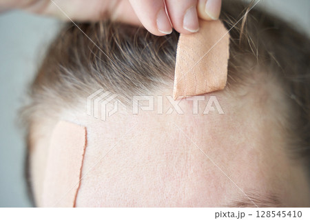 Caucasian female applying healing bandage on forehead wound for skin care Caucasian female applying healing bandage on forehead wound for skin care 128545410