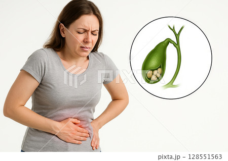 Woman experiencing pain in right side with illustration of gallbladder with stones. concept of abdominal pain, health issues, medical awareness, white background 128551563