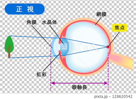 眼睛的結構、正常視力、視力 128620542