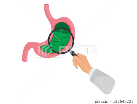 Helicobacter Pylori in the stomach stock illustration Helicobacter Pylori in the stomach stock illustration 128643225