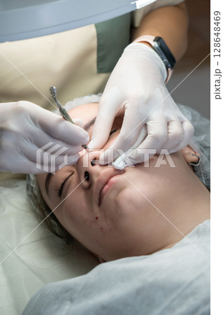 Dermaplaning Procedure Clinic Facial Hair Removal: Close-up showing a dermaplaning procedure performed by a professional in a clinic setting. 128648469