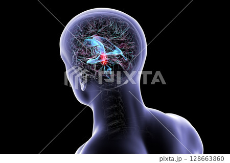 Cerebral aqueduct and ventricles, 3D illustration 128663860