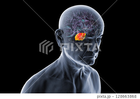 Human brain in a senior person with highlighted pons, essential for motor control and sleep, often impacted in age-related disorders like Parkinson's and vascular dementia, 3D illustration. 128663868