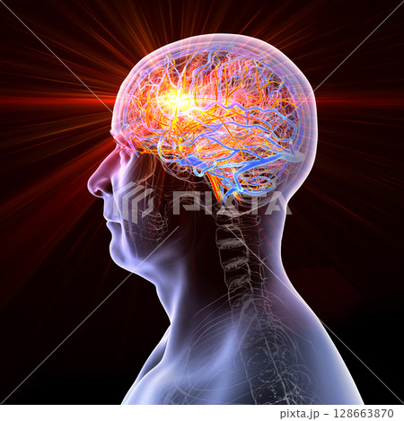 Brain stroke, 3D conceptual illustration showing human brain with highlighted vessels and light flash indicating sudden vascular event or occlusion. Brain stroke, 3D conceptual illustration showing human brain with highlighted vessels and light flash indicating sudden vascular event or occlusion. 128663870