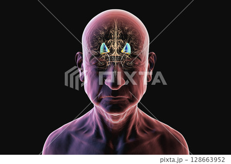 Human brain with highlighted putamen in blue and globus pallidus in yellow, showing basal ganglia structures essential for motor control and affected in movement disorders, 3D illustration. 128663952