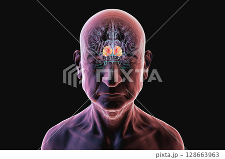 Thalamus, 3D illustration of human brain in a senior person, highlighted to show its role in age-related cognitive decline and neurodegeneration. Thalamus, 3D illustration of human brain in a senior person, highlighted to show its role in age-related cognitive decline and neurodegeneration. 128663963