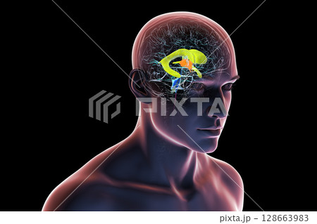 Human brain with colored ventricles, 3D illustration, lateral (yellow), third (orange), fourth (blue), interventricular foramen (green), cerebral aqueduct (dark purple), spinal channel (light purple). 128663983