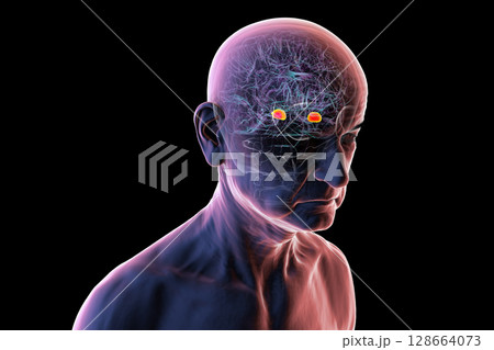 Human brain with highlighted amygdala, 3D illustration 128664073
