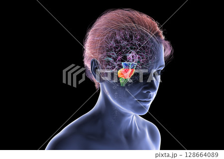 Brainstem highlighted in human brain, 3D illustration Brainstem highlighted in human brain, 3D illustration 128664089
