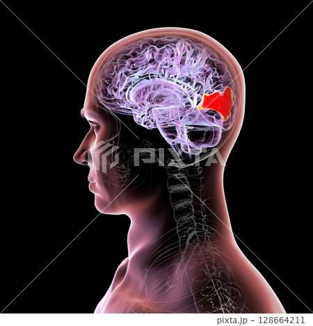 Human brain with highlighted cuneus gyrus, 3D illustration. A visual processing area in the occipital lobe involved in attention, vision, and spatial orientation. Human brain with highlighted cuneus gyrus, 3D illustration. A visual processing area in the occipital lobe involved in attention, vision, and spatial orientation. 128664211