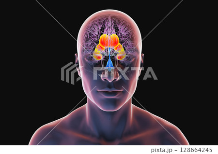 Enlarged lateral ventricles of the brain, 3D illustration Enlarged lateral ventricles of the brain, 3D illustration 128664245