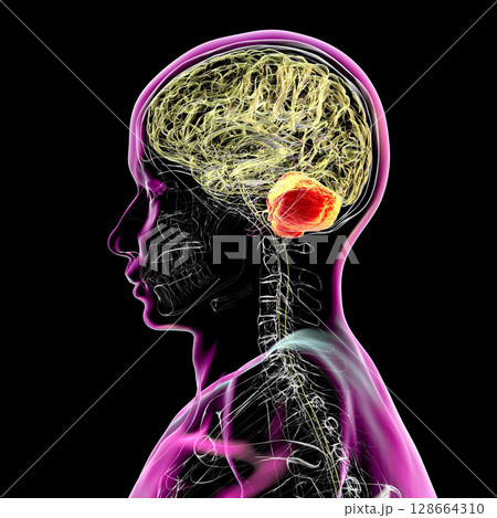 Human brain with highlighted cerebellum, 3D illustration. Cerebellum is responsible for coordination, balance, and fine motor control. Damaged in ataxia and neurodegenerative disorders Human brain with highlighted cerebellum, 3D illustration. Cerebellum is responsible for coordination, balance, and fine motor control. Damaged in ataxia and neurodegenerative disorders 128664310
