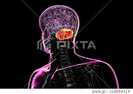 Human brain with highlighted cerebellum, 3D illustration. Cerebellum is responsible for coordination, balance, and fine motor control. Damaged in ataxia and neurodegenerative disorders Human brain with highlighted cerebellum, 3D illustration. Cerebellum is responsible for coordination, balance, and fine motor control. Damaged in ataxia and neurodegenerative disorders 128664314