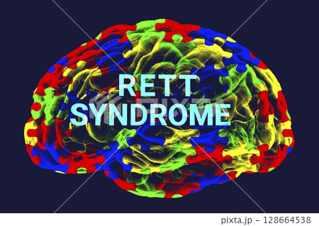A conceptual 3D illustration featuring the text Rett syndrome inside the anatomical model of a human brain with a colorful puzzle pattern on its surface 128664538