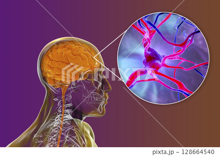 Human brain with closeup view of brain cells, neurons 128664540