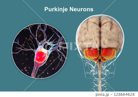 Human brain with highlighted cerebellum and close-up of Purkinje neurons, 3D illustration. Cerebellum controls balance and coordination, Purkinje cells are key neurons in motor function. 128664628